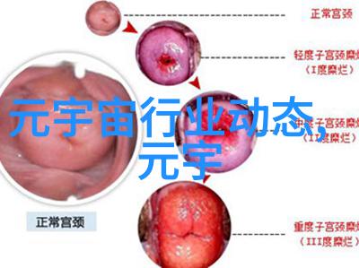 为进一步提高VR产品体验苹果将研发8K微型显示器